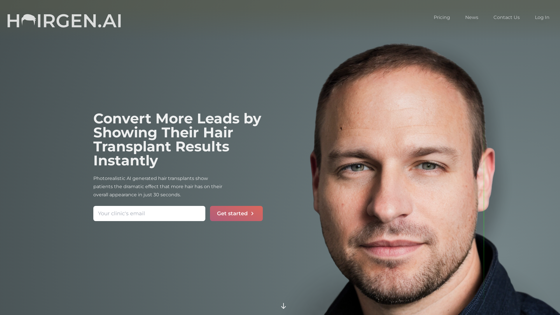 Preview your FUE/FUT hair transplant using AI