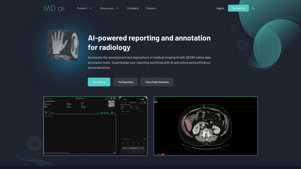 MD.ai screenshot